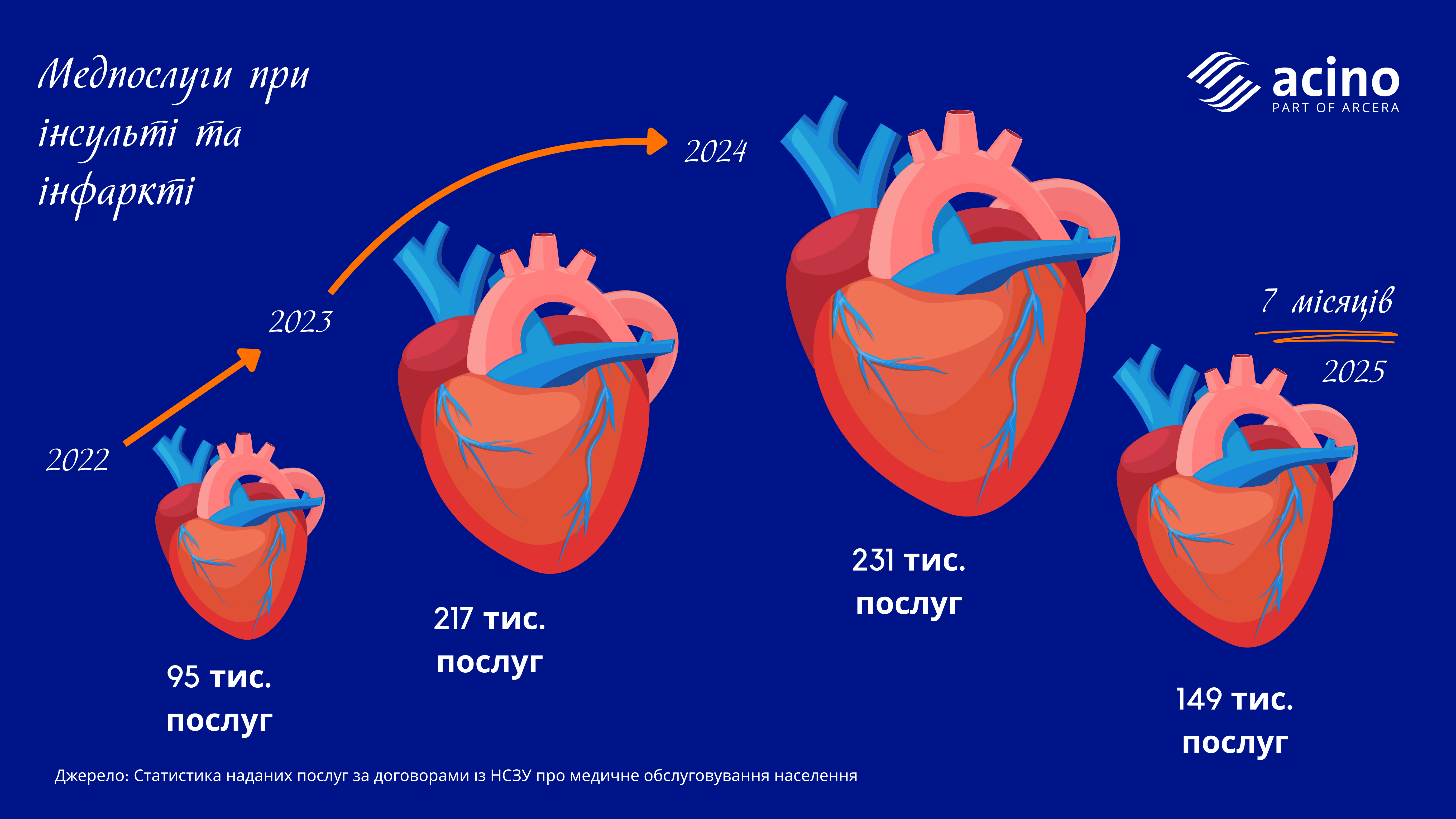 Медпослуги при інсульті і інфаркті